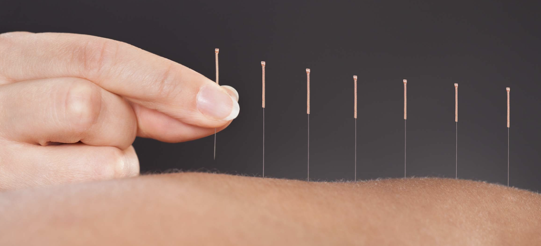 Sekilas Tentang - Perhimpunan Dokter Spesialis Akupunktur Medik Indonesia